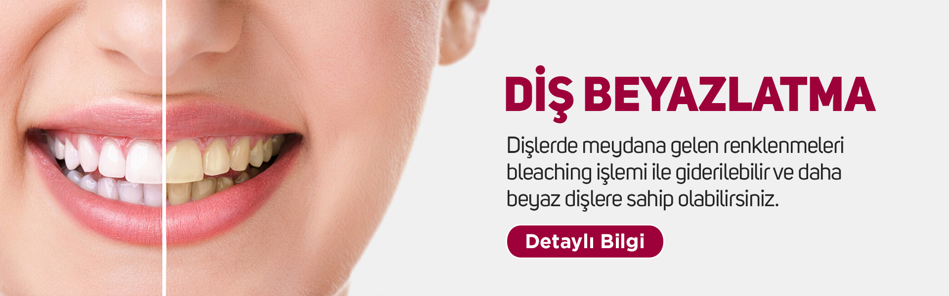 Adental - Ağız ve Diş Sağlığı Polikliniği