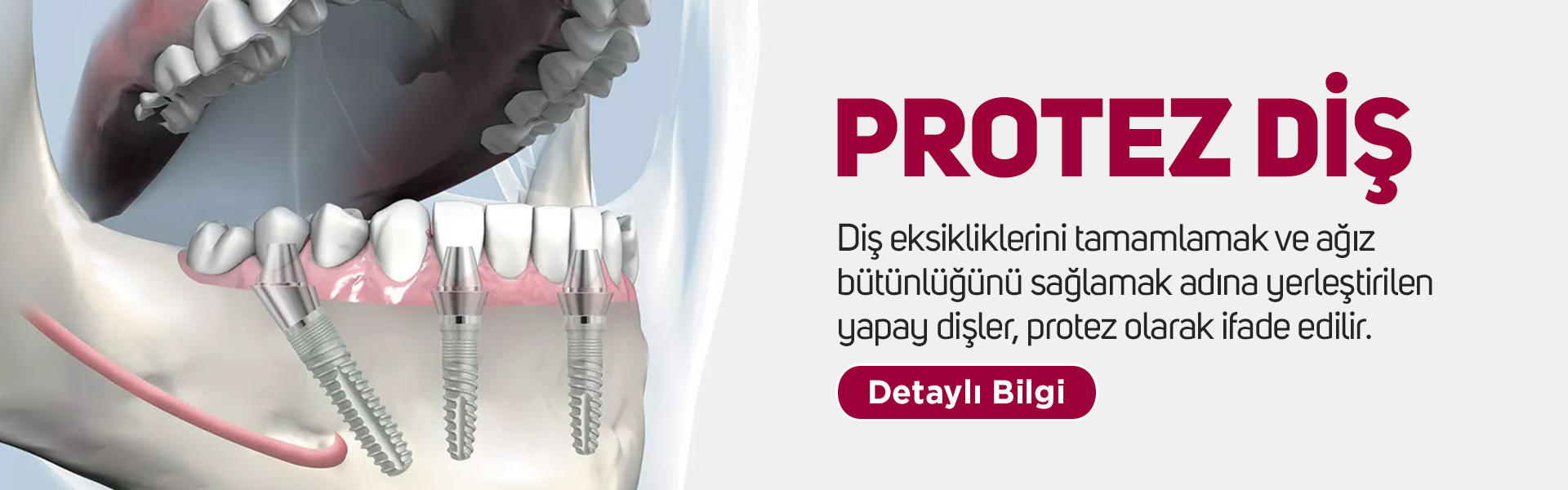 Adental - Ağız ve Diş Sağlığı Polikliniği