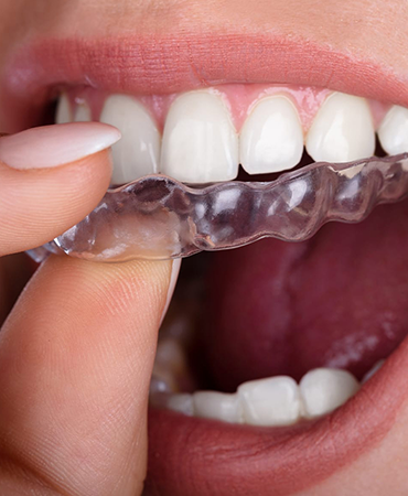 Adental - Ağız ve Diş Sağlığı Polikliniği