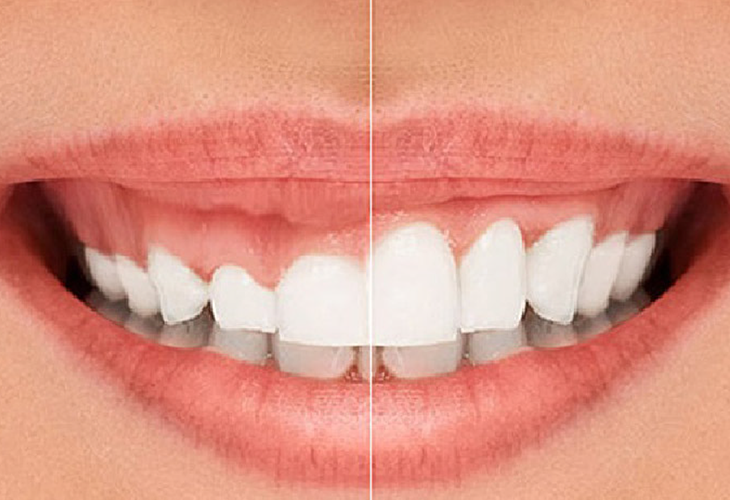 Adental - Ağız ve Diş Sağlığı Polikliniği