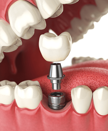 Adental - Ağız ve Diş Sağlığı Polikliniği