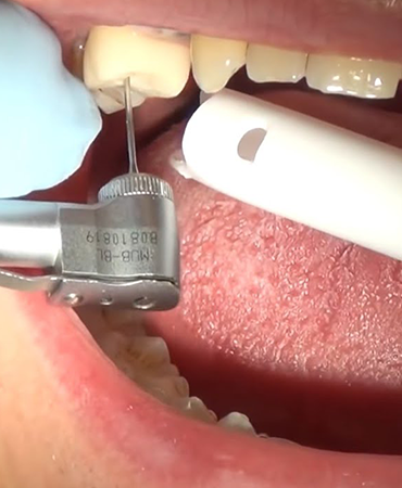 Adental - Ağız ve Diş Sağlığı Polikliniği