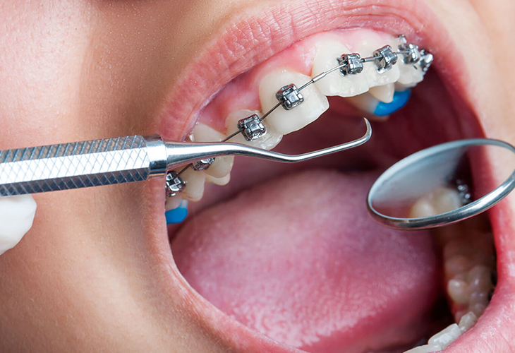 Adental - Ağız ve Diş Sağlığı Polikliniği
