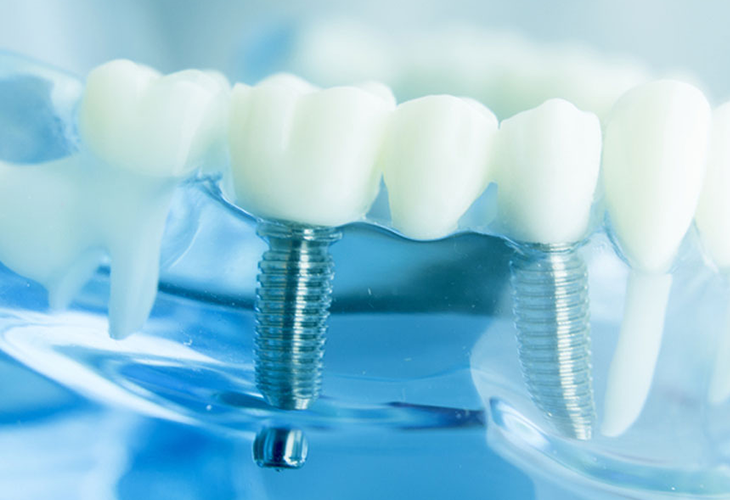 Adental - Ağız ve Diş Sağlığı Polikliniği